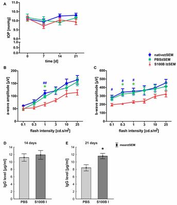 Intravitreal S100B Injection Leads to Progressive Glaucoma Like Damage in Retina and Optic Nerve